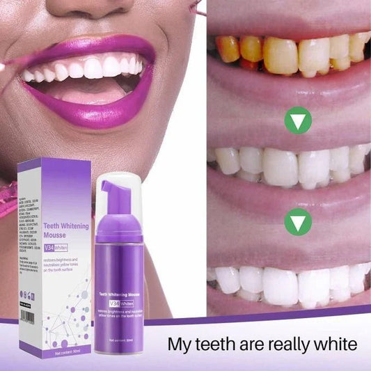 Lanthome teeth whitening mousse