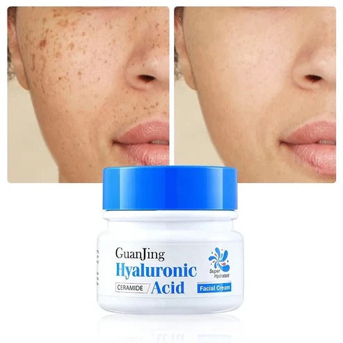 Guanjing Hyaluronic Acid Face Cream – 50g