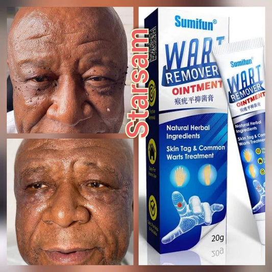 Sumifun Wart Remover Ointment 20g