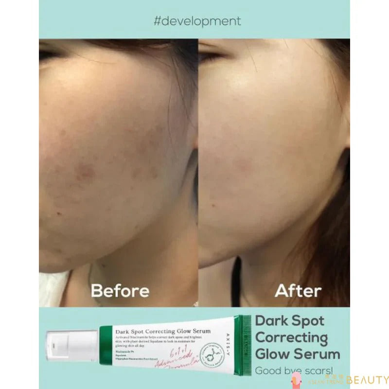 AXIS‑Y Dark Spot Correcting Glow Serum — 50ml Dark Spot Correcting Glow Serum-50ml