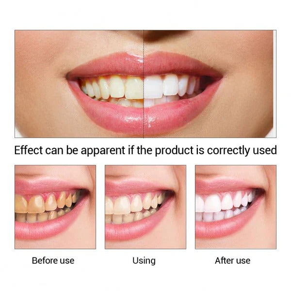 LANBENA professional teeth whitening essence liquid