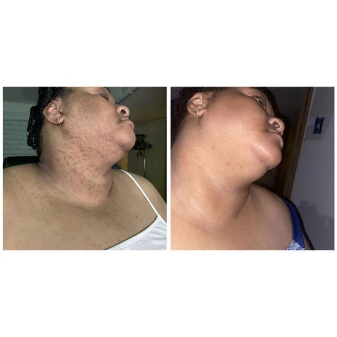 The Ordinary Alpha Arbutin 2% + HA Brightening Serum