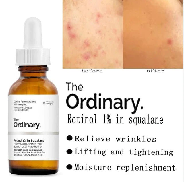 The Ordinary Retinol 1% in Squalane – 30ml